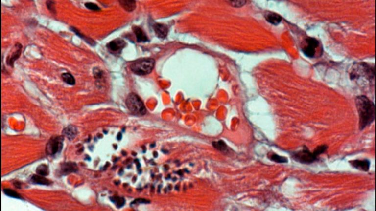 Imagen de microscopía de tejido cardíaco infectado con T. cruzi. Créditos: Gentileza de María del Pilar Aoki.