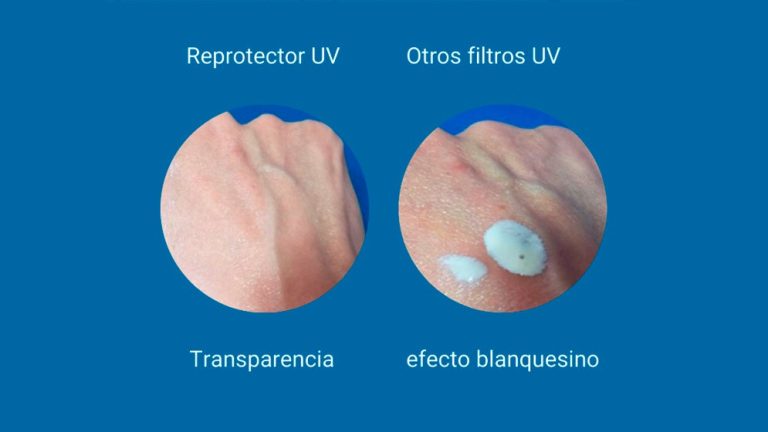 Gracias a la utilización de tecnología nanométrica, la formula cosmética propuesta por el equipo del CONICET evita el indeseado efecto blanquecino sobre la piel de otros filtros solares con nanopartículas.