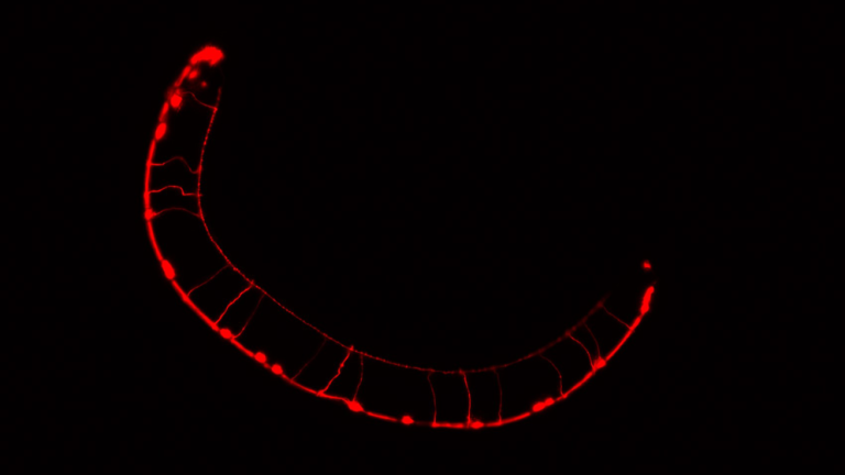 Disposición de las neuronas GABAergicas (inhibitorias) en C. elegans. Foto: gentileza investigadores.